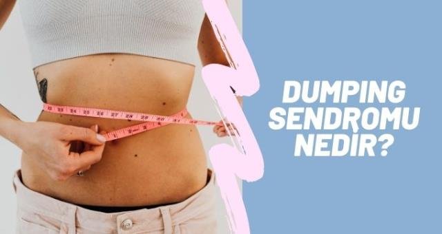 Dumping sendromu nedir? Seren Serengil’in hastalığı nedir? umping sendorumu belirtileri nelerdir? Dumping sendromu tedavisi!