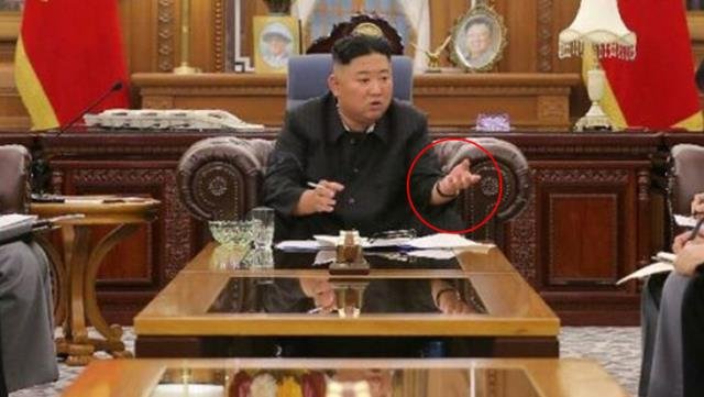 Kilo kaybı yaşayan Kim Jong-un’un sağlık durumu endişelendirdi