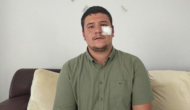 Saldırıya uğrayan İHA muhabiri Akşener’i yalanladı