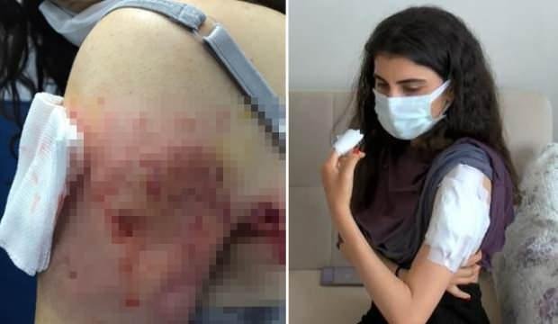 Sarıyer’de işe gitmek için evden çıkan genç kıza, sokak köpekleri saldırdı