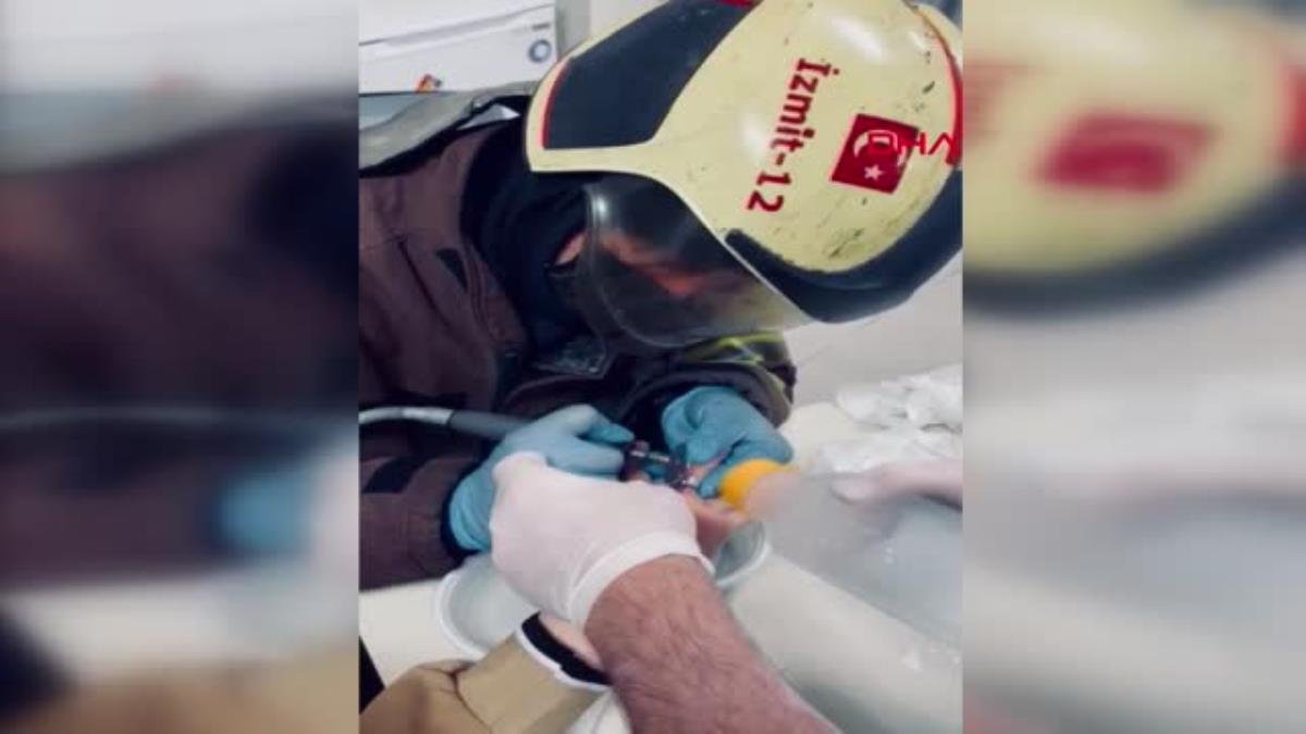 Son dakika! KOCAELİ Parmağa sıkışan yüzüğü itfaiye keserek çıkardı
