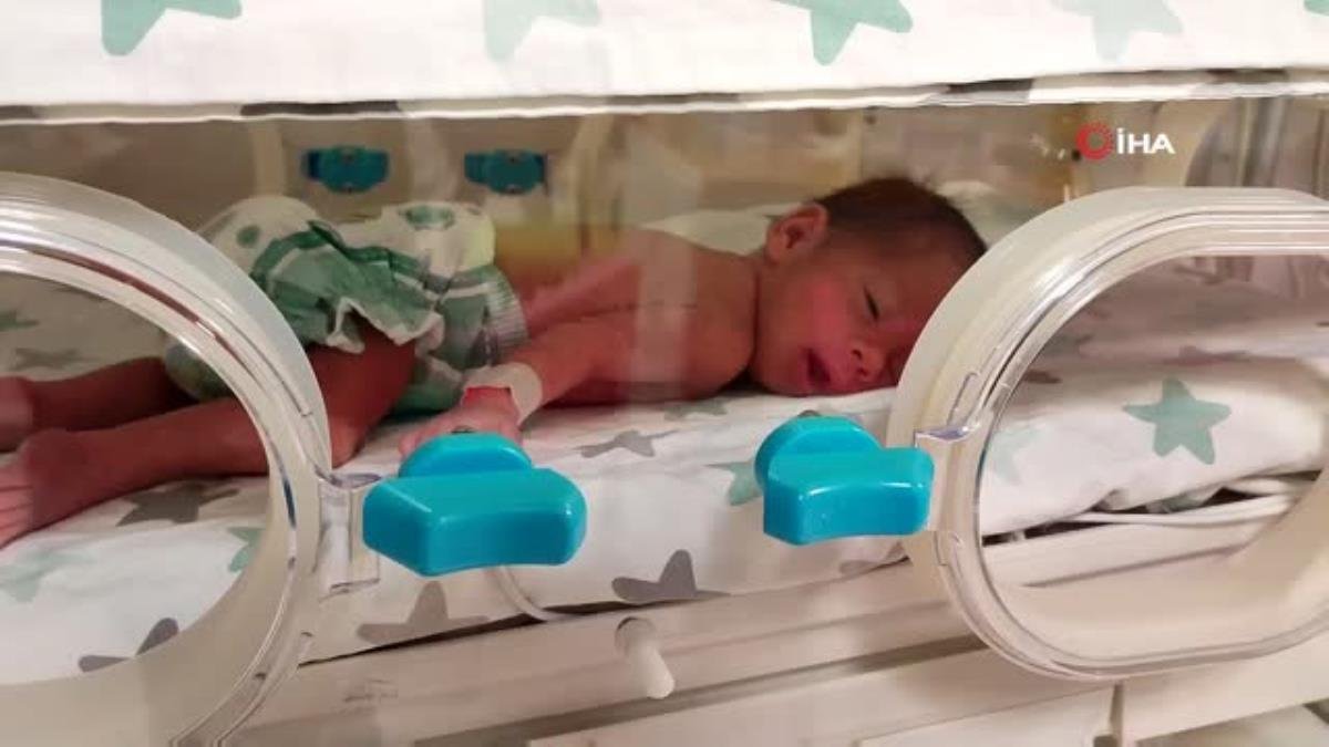 Suriyeli ikizler Türkiye’de şifa buldu