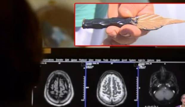 Akılalmaz olay! Doktor fark etmedi, 1 gün boyunca böyle gezdi