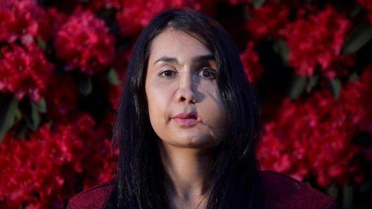 Eşi tarafından suratından vurulan Şakila Zareen, Afganistan’da kadınlara olan bakış açısını anlattı