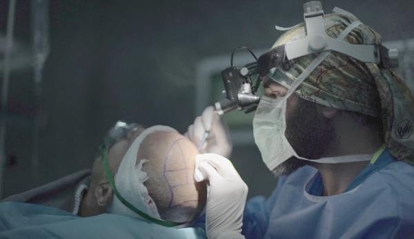 İSTANBUL-Aziz Aksöz: Saç dökülmesi ergenlik öncesinde görülmeye başladı