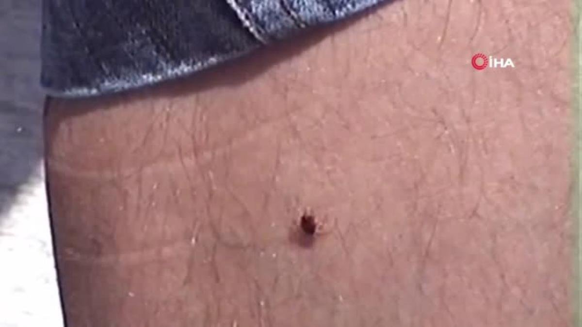 Son dakika haberleri: Gümüşhane’de keneden 4.ölüm