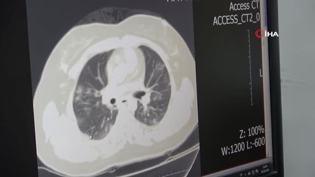 Uzman doktordan ‘aşı olun’ çağrısı