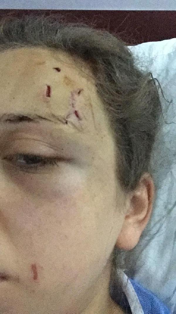 Eski eşinin 5 saat şiddet uyguladığı kadın: Kızımı da alıp kaçtı