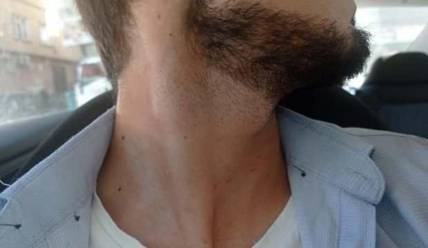 Gaziantep’te, A Haber ekibine otoparkta saldırı