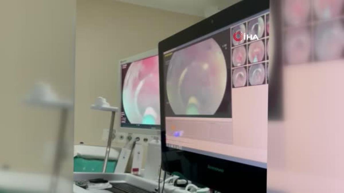 Japonya da yapılabilen ‘Akalazya’ işlemi Kahramanmaraş’ta da yapıldı