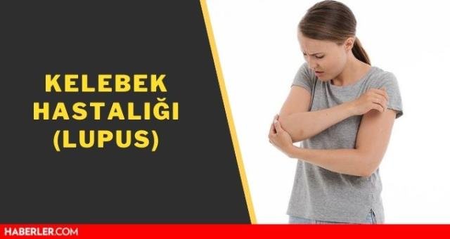 Kelebek hastalığı! Lupus (Kelebek hastalığı) nedir? SLE nedir, belirtileri nelerdir?