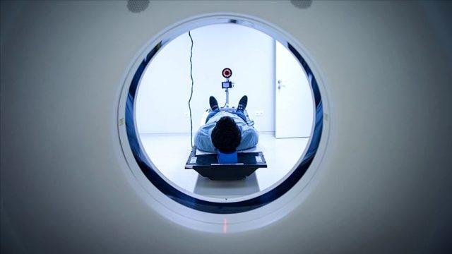 Parkinson hastalığı nedir? Parkinson hastalığı belirtileri nelerdir? Parkinson hastalığı kimlerde görülür? Parkinson evreleri nelerdir?