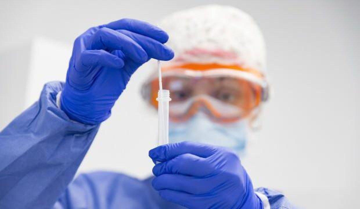 Bilim Kurulu Üyesi Özkan’dan uyarı: PCR testinin negatifliğine güvenmeyin