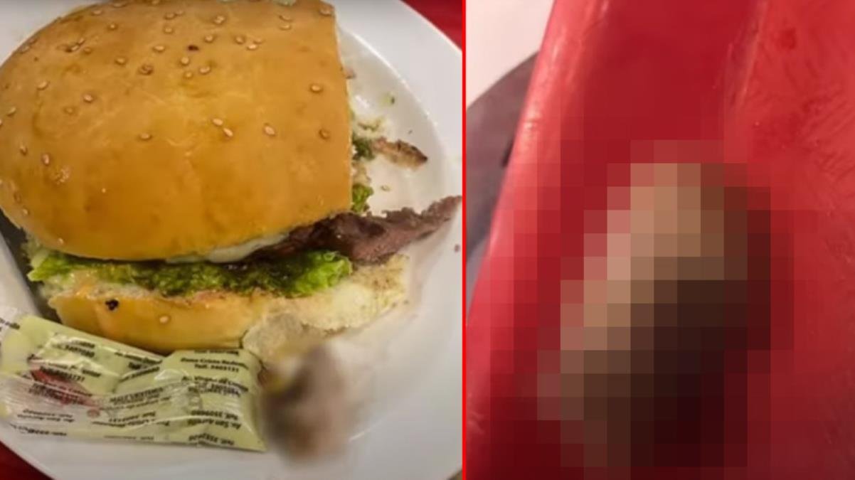 Bolivya’da bir kadının yediği hamburgerden insan parmağı çıktı