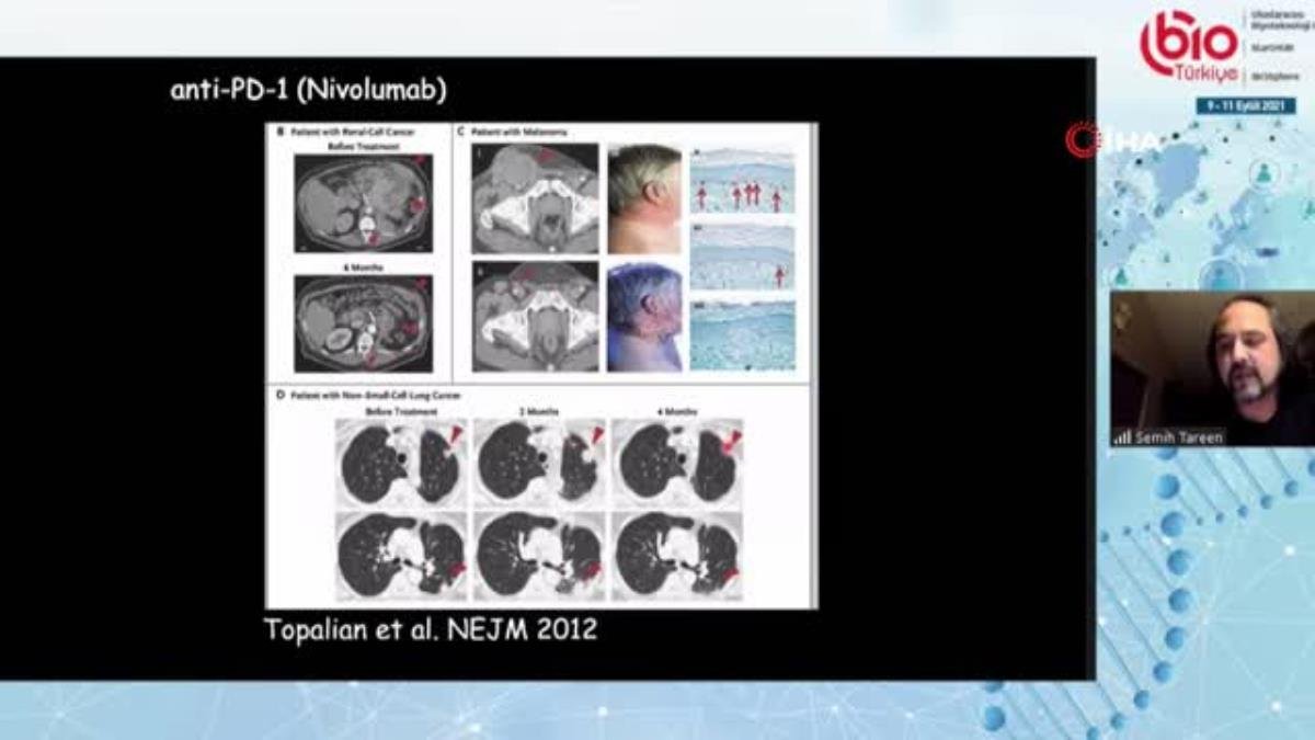 Kanserde gen aktarımıyla tedavi üretiliyor