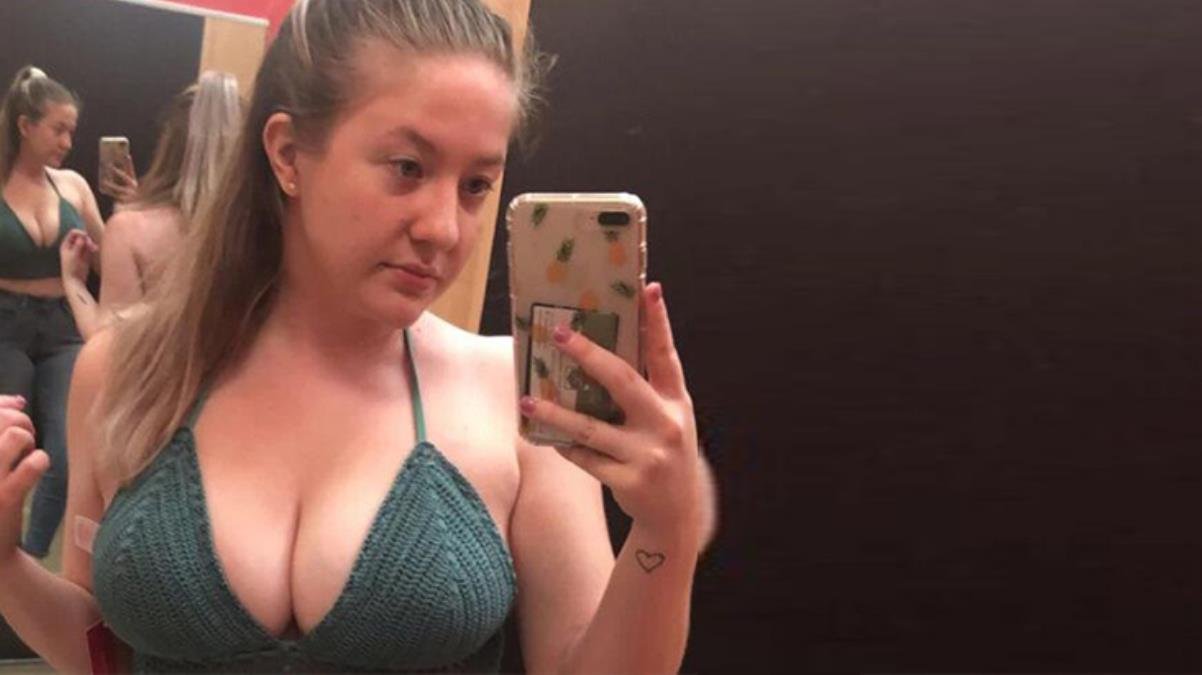 Kıyafetleri teker teker patlıyor! Genç kadına göğüs küçültme ameliyatı da fayda etmedi