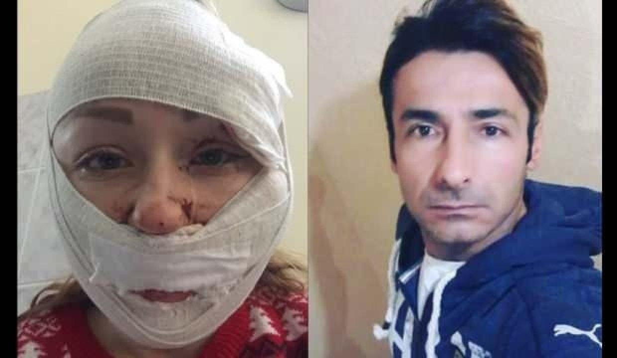 Mahkemede “falçata ile bilerek vurdum” dedi “iyi hal” indirimi aldı