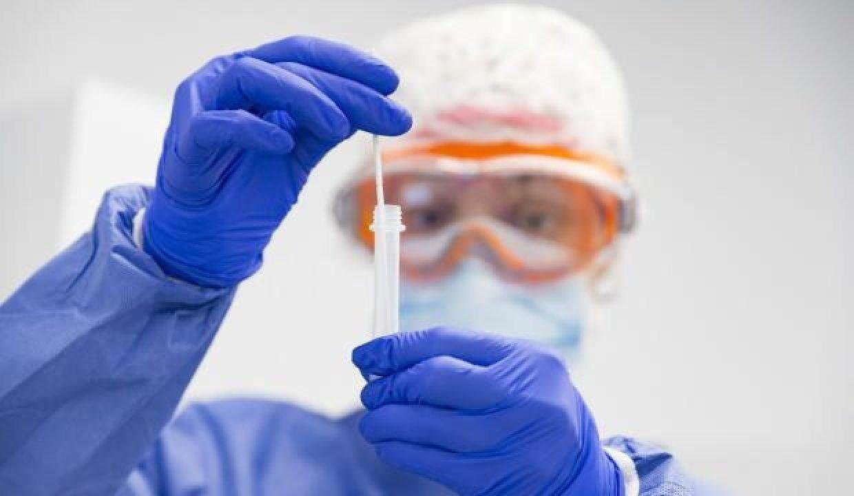 Prof. Dr. Mehmet Ceyhan: Gribi koronavirüsten ayırmanın tek yolu var!