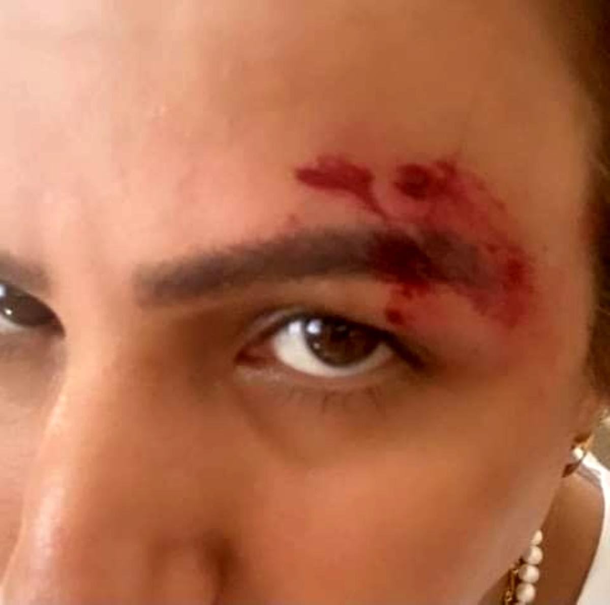 Zafer Parti’li Çelik’in “Suriyeliler saldırdı” palavrası tutmadı