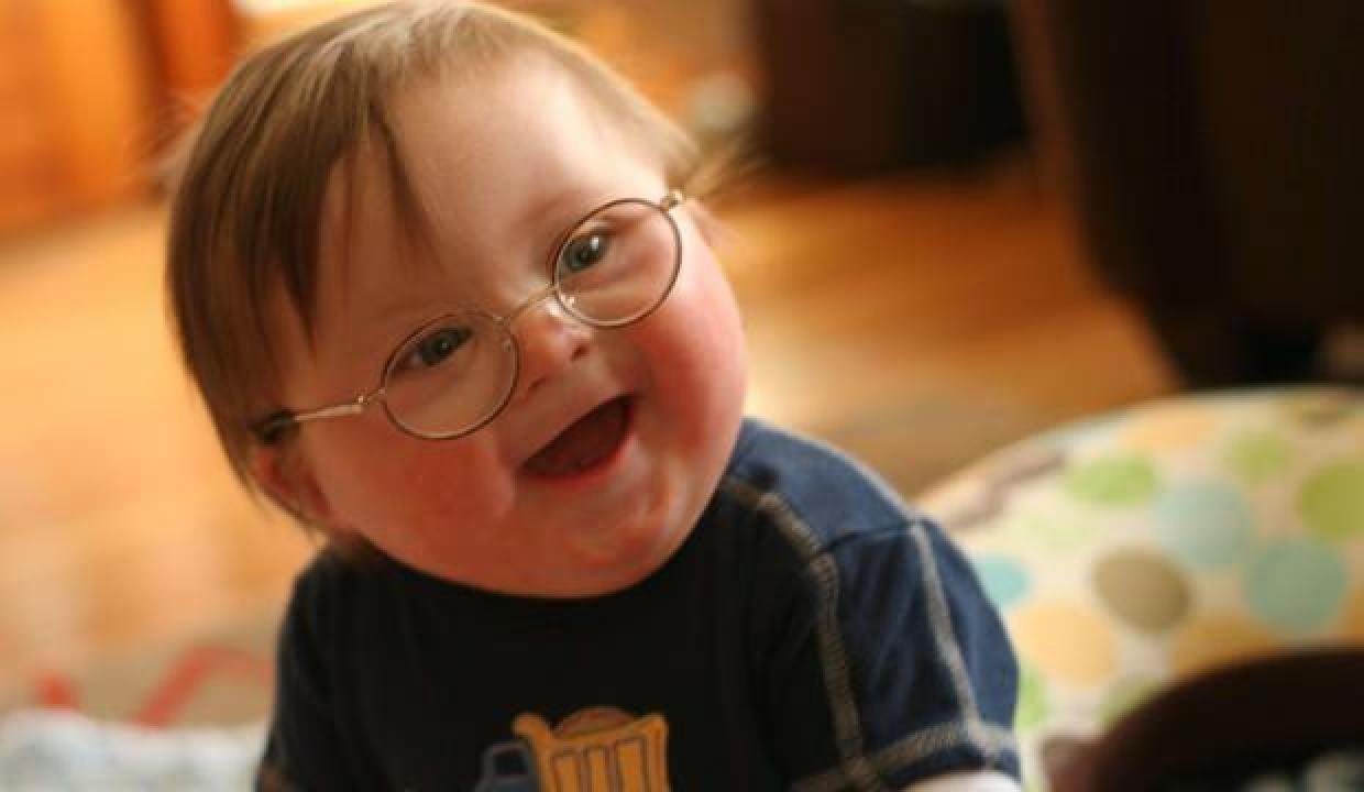 Yargıtay’dan down sendromu kararı! Hekimler ailelere tazminat ödeyebilir