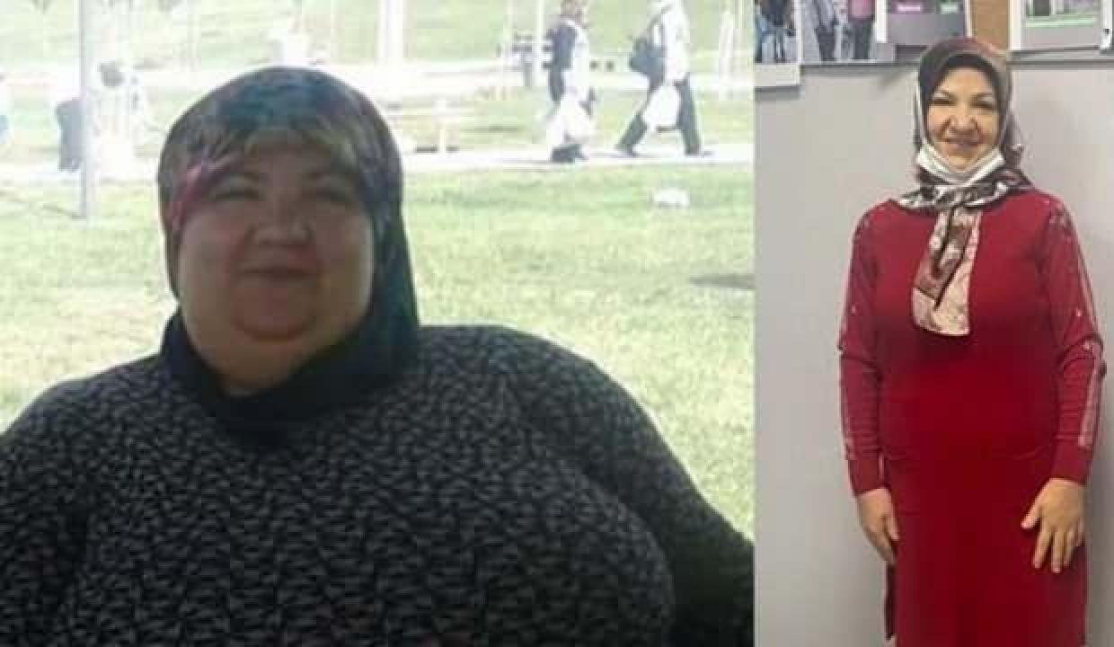 2 yılda 95 kilo verdi: Çorabımı bile giyemiyordum