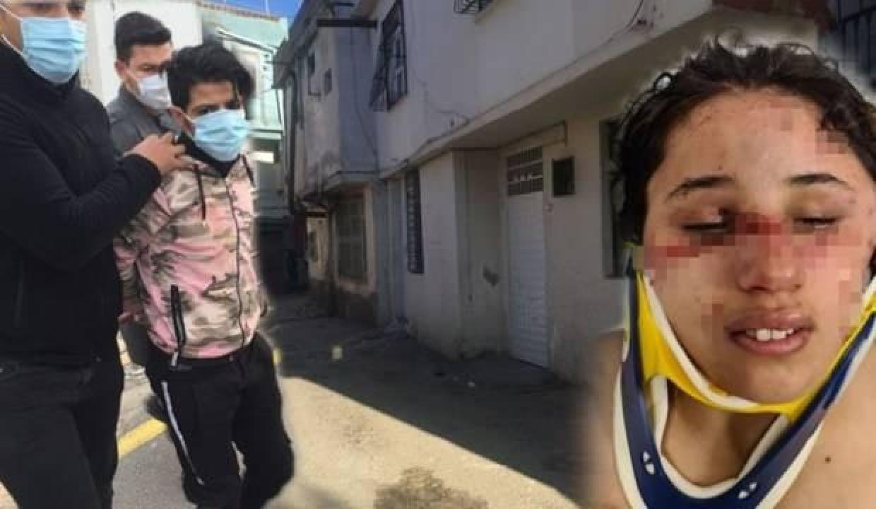 7 aylık gebe eşe günlerce azap yaptı! Beyin kanaması var…