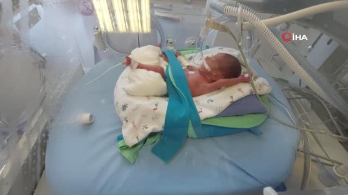 495 gramlık prematüre bebeğe kök hücre nakli: Dünyada ve Türkiye’de sayılı nakil!