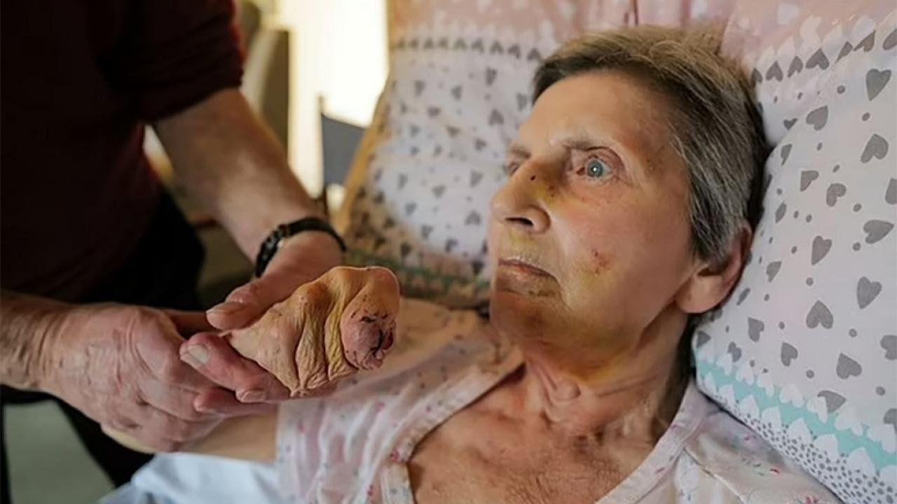 İngiltere’de yaşlı kadın, fare saldırısına uğradı