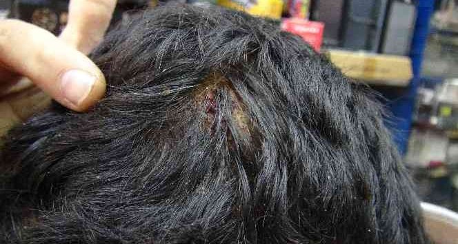 50 Liralık Kumanda İçin Dükkan Basıp Adam Yaraladılar