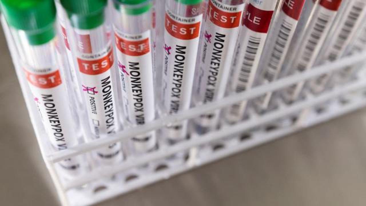 DSÖ: Avrupa’da maymun çiçeği vakaları üçe katlandı