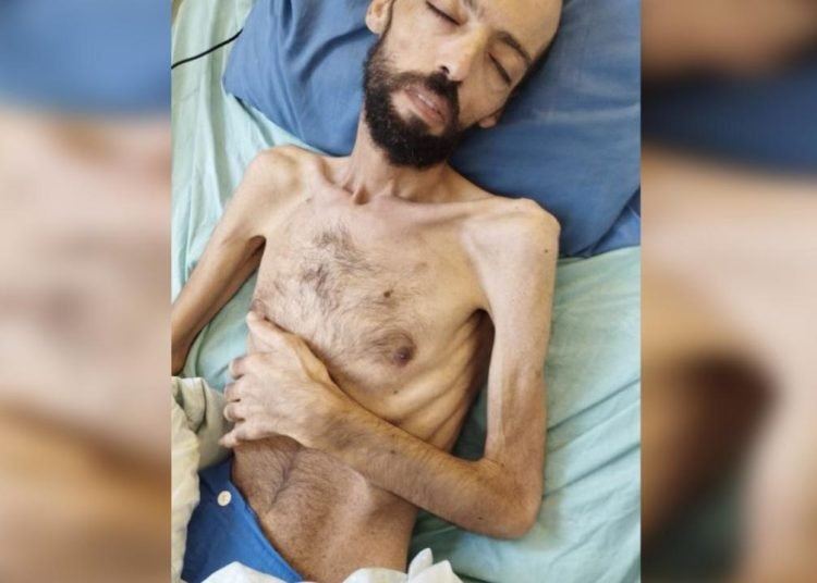 Açlık grevindeki Filistinli: Bu beden siyonist işgalcilerin gerçek yüzünü yansıtıyor