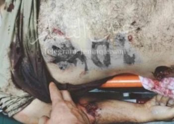 İsrail askerlerinin vahşiliği: Filistinli şehidin cesedine bunu yazdılar!