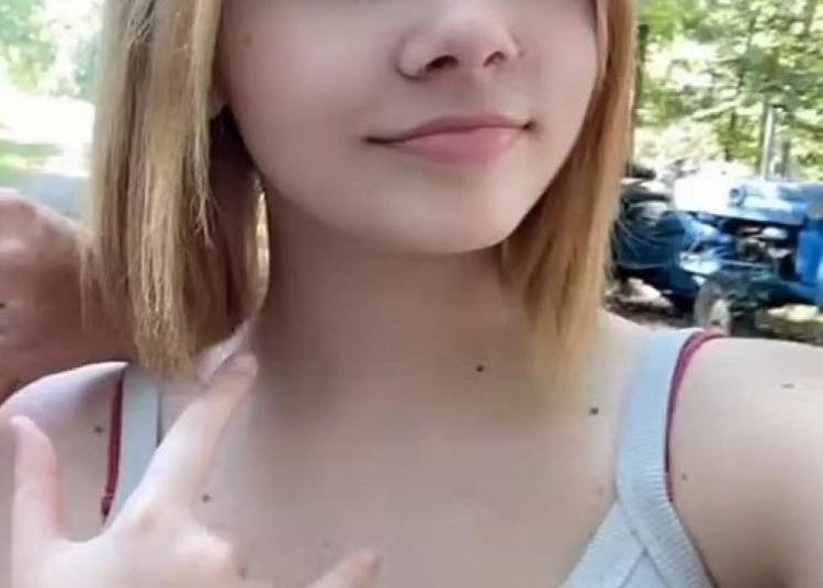 Suya alerjisi olan kızın hayatı kabusa döndü