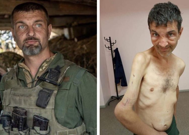 Takası Türkiye’de yapılan askerin görüntüsü şoke etti