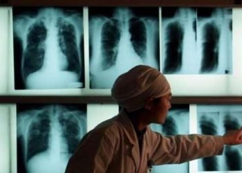 Verem tedavisini reddeden hastaya tutuklama kararı çıkarıldı