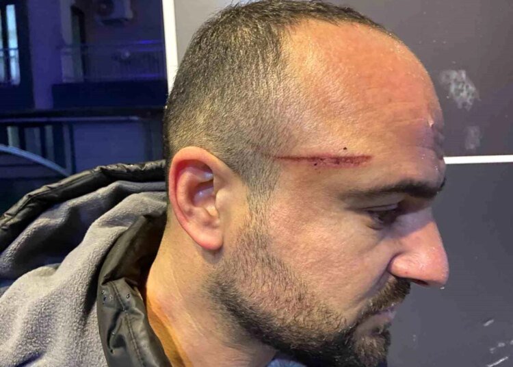 Gebze’de İşe Giderken Saldırıya Uğradı