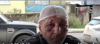 Çakmak İsteyip 67 Yaşındaki Adamı Darbettiler